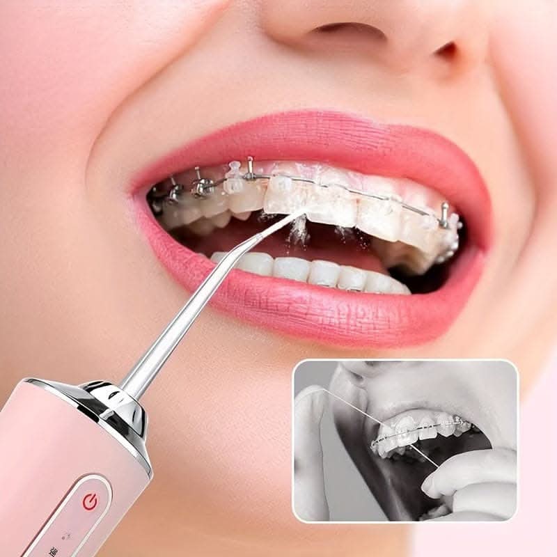 Portable Dental Water Flosser – USB Rechargeable, 4 Jet Tips, 3 Modes, Waterproof