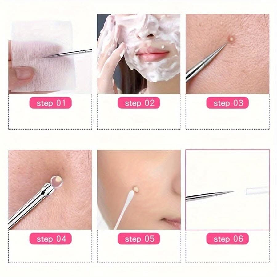 Precision Stainless Steel Blackhead & Blemish Remover
