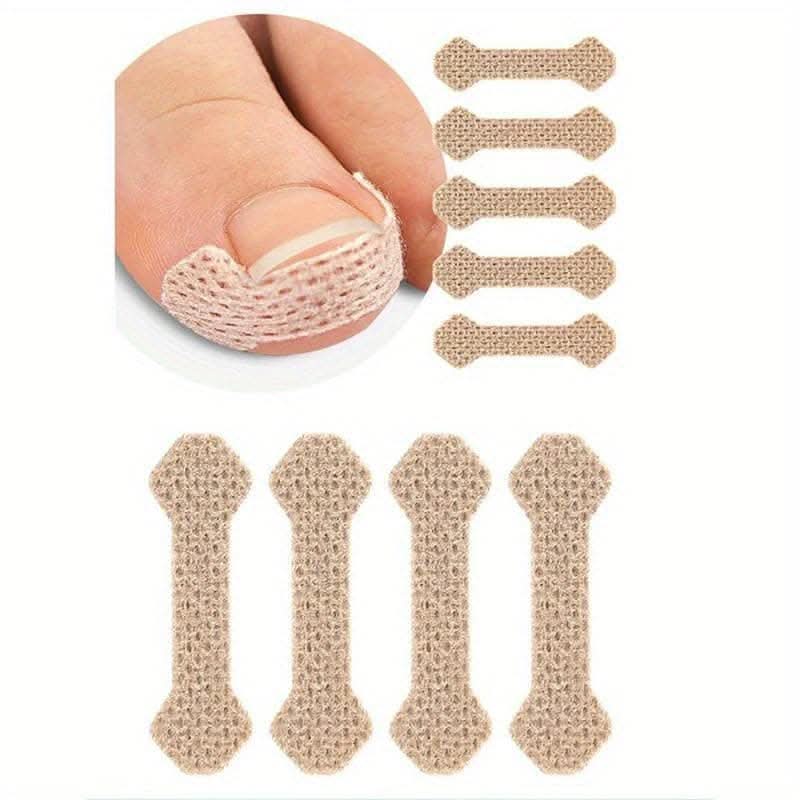 10 pcs. Ingrown Toenail Correction Stickers - Paronychia Treatment Patches