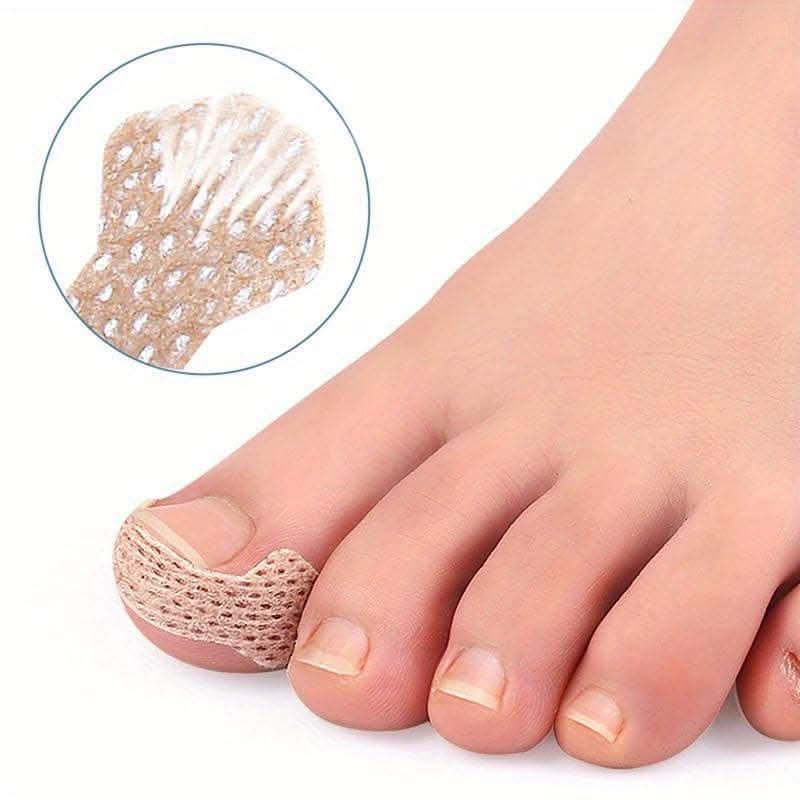 10 pcs. Ingrown Toenail Correction Stickers - Paronychia Treatment Patches