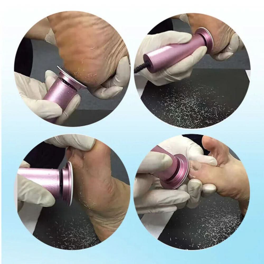 Electric Pedicure Foot File – High-Torque Callus Remover with 360° Rotation