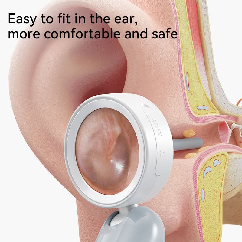 4-in-1 Smart Ear & Nose Camera – HD Endoscope with 90° Rotating Lens