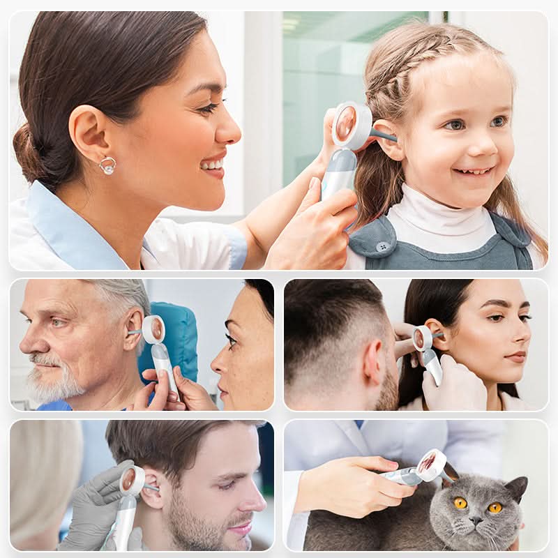 4-in-1 Smart Ear & Nose Camera – HD Endoscope with 90° Rotating Lens
