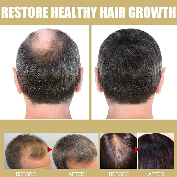 LED Hair Growth Cap – Infrared Red Light Scalp Therapy Device for Hair Care & Nourishment