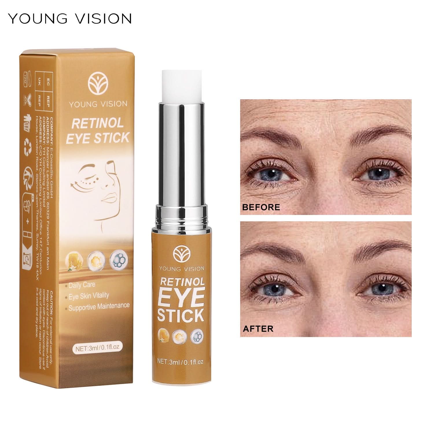 YOUNG VISION Retinol Eye Cream Stick – Reduces Dark Circles, Eye Bags & Fine Lines