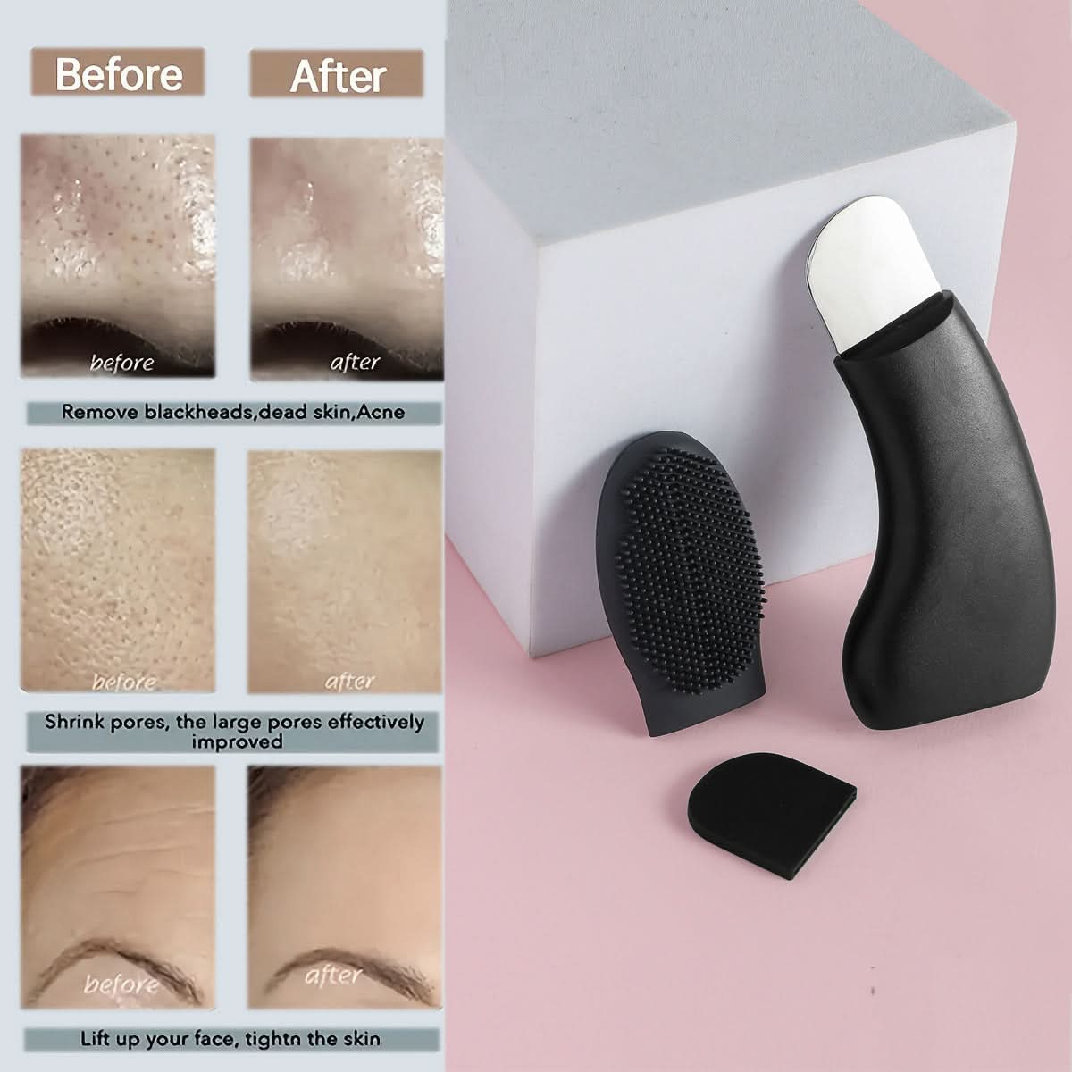 Manual Blackhead Remover Tool – Silicone Scraper for Deep Pore Cleaning