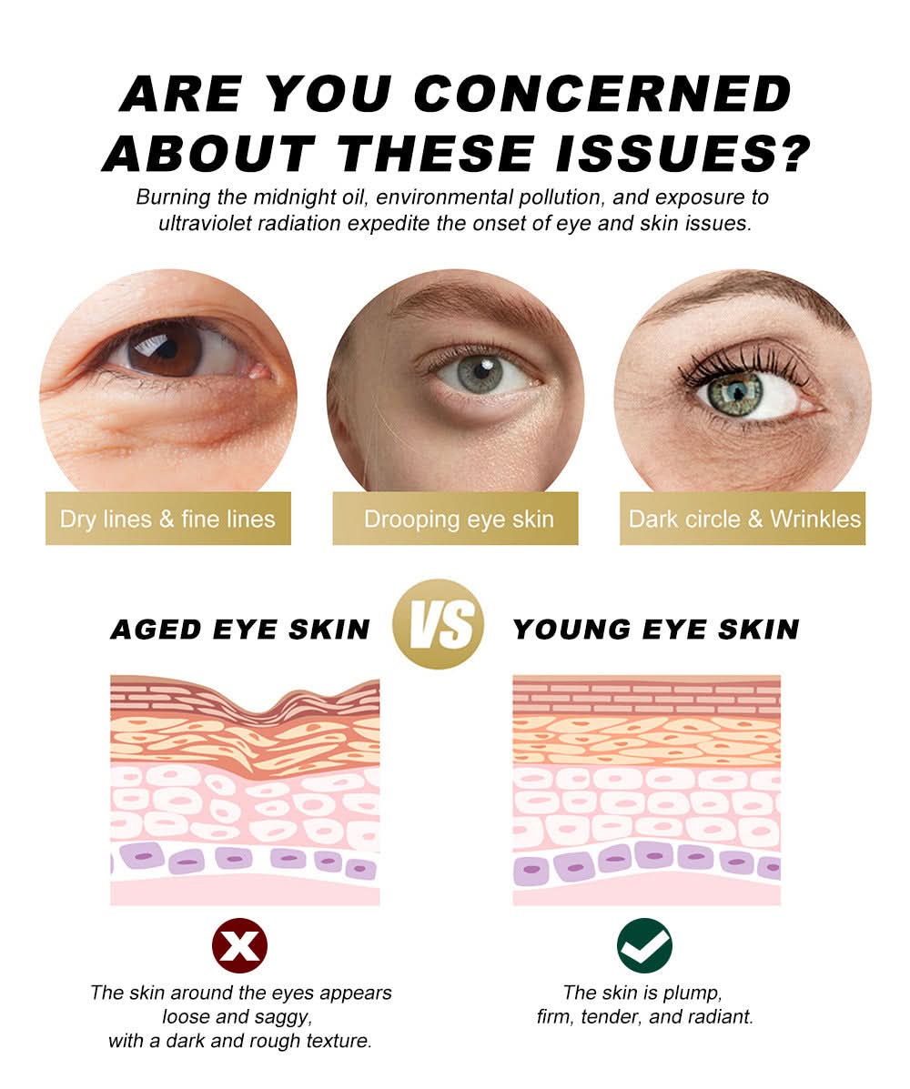 YOUNG VISION Retinol Eye Cream Stick – Reduces Dark Circles, Eye Bags & Fine Lines