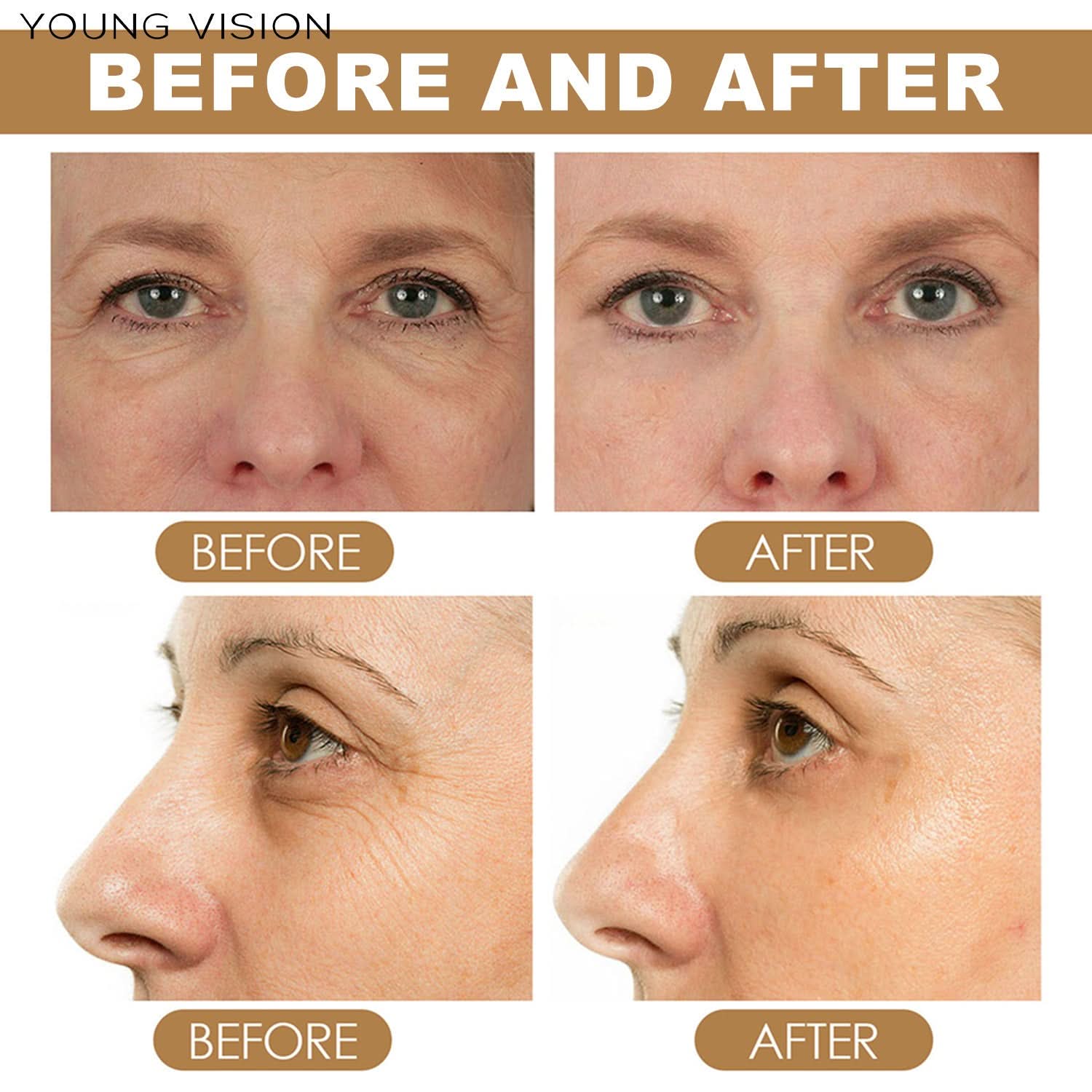 YOUNG VISION Retinol Eye Cream Stick – Reduces Dark Circles, Eye Bags & Fine Lines