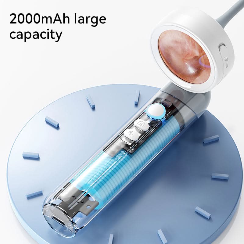 4-in-1 Smart Ear & Nose Camera – HD Endoscope with 90° Rotating Lens