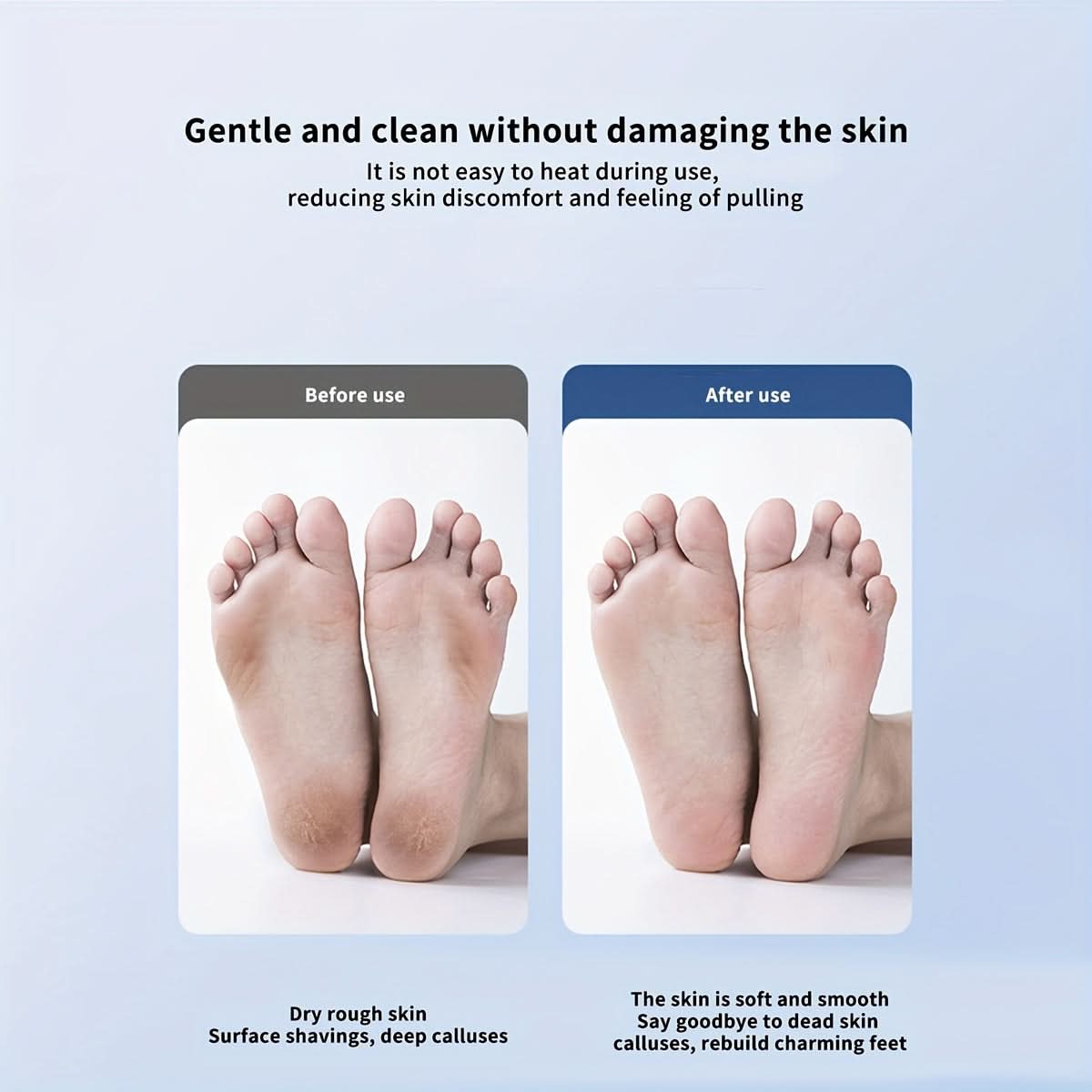 ProFoot Electric Foot Grinder for Callus Removal